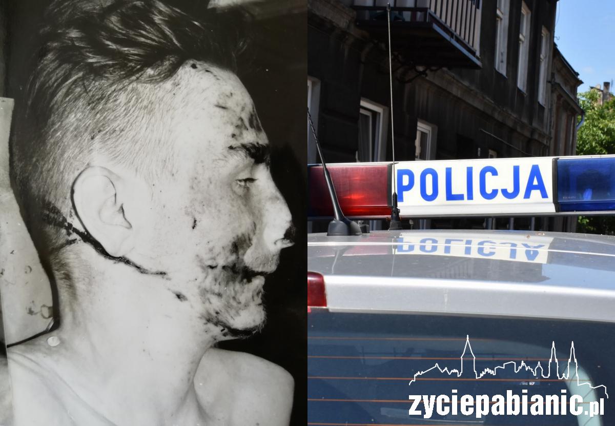 Kto rozpoznaje denata?