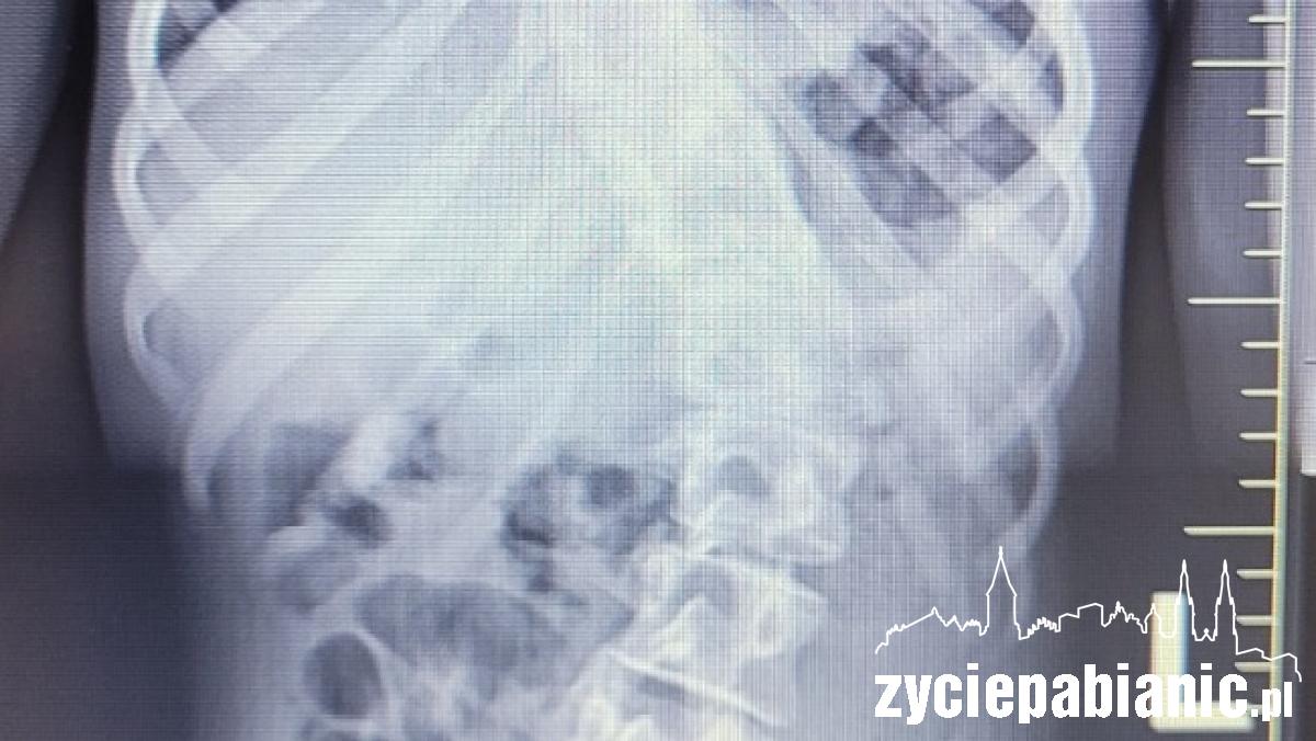 Potrzebna pomoc dla młodziutkiej Klaudii