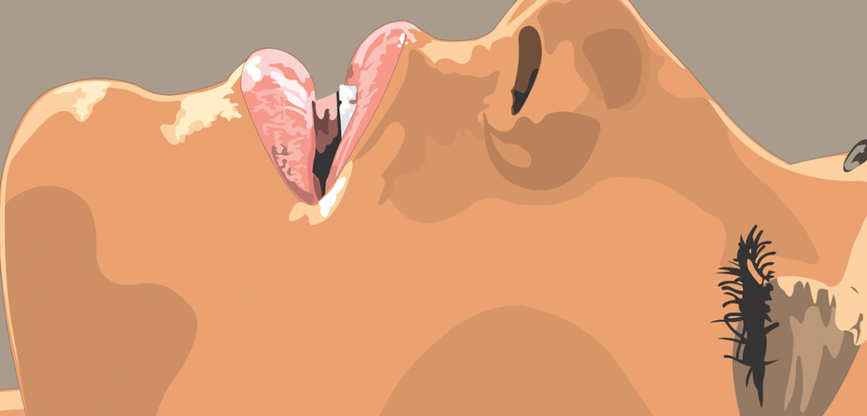 Wypełnianie ust - czy to bezpieczny zabieg?