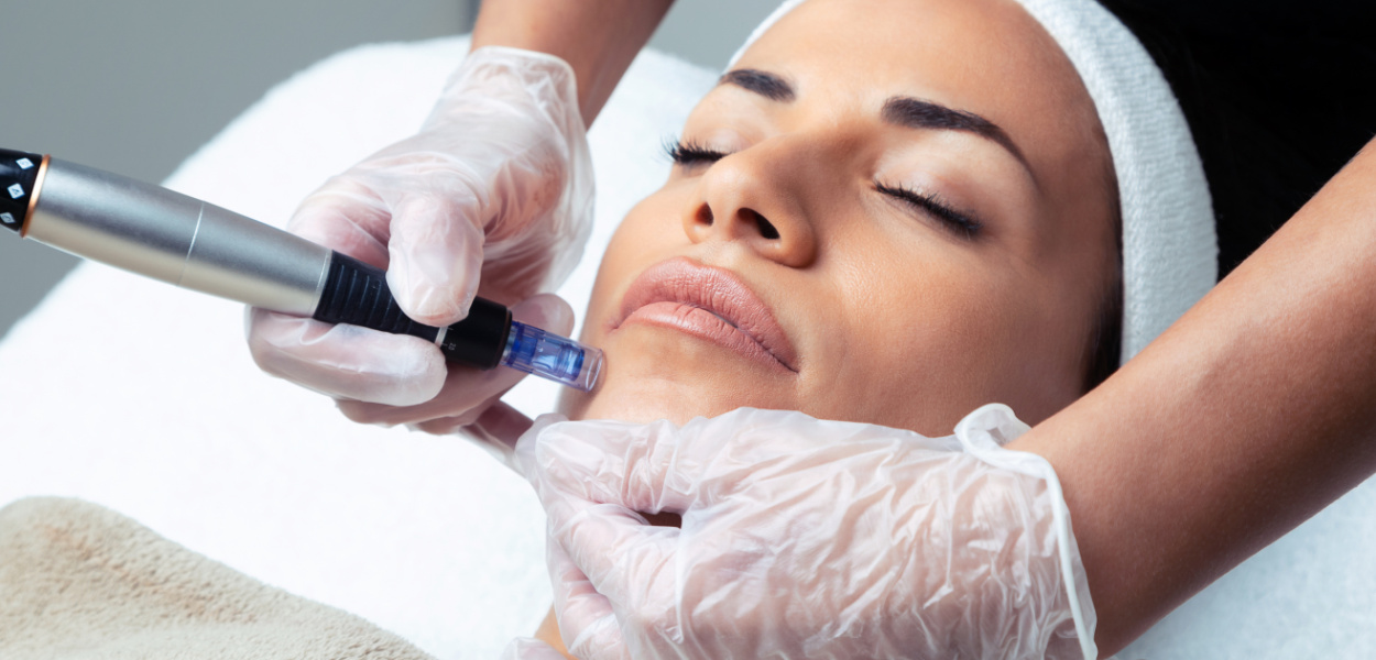 Dermapen - efektowny zabieg dla naszej skóry