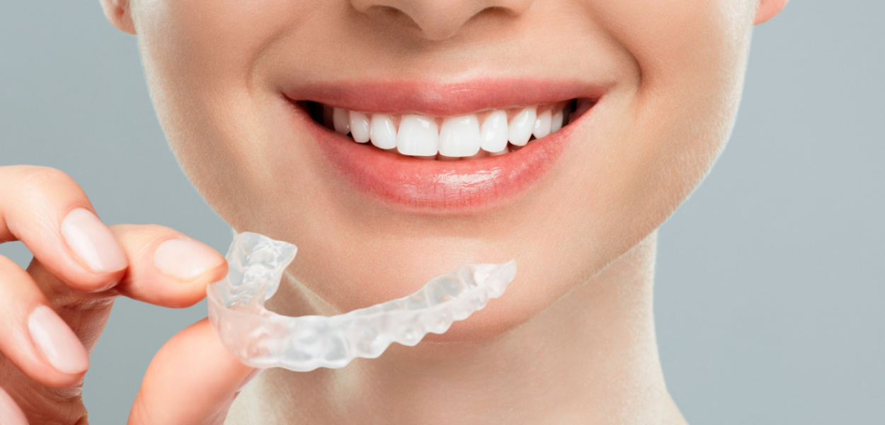 Kiedy wybrać leczenie ortodontyczne zamiast protetycznego?